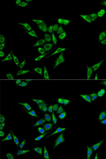 Polyclonal Rabbit anti-Human ACAT1 Antibody (IHC, IF, WB)