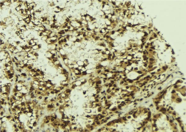 NFKBIZ / IKBZ Antibody
