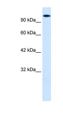 HIPK2 Antibody (aa384-433)