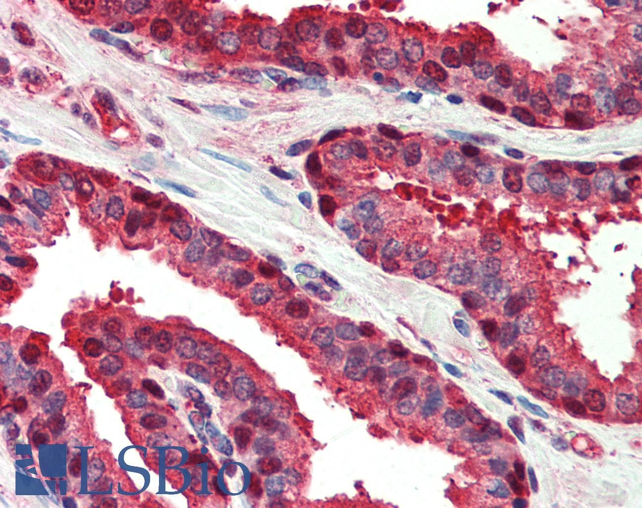 IHC-plus™ CASP6 / Caspase 6 Antibody