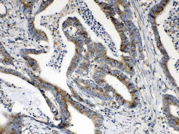 Polyclonal Rabbit anti-Human HSD17B4 Antibody (IHC, WB)