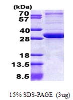 Human PEX26 Protein (Recombinant His)