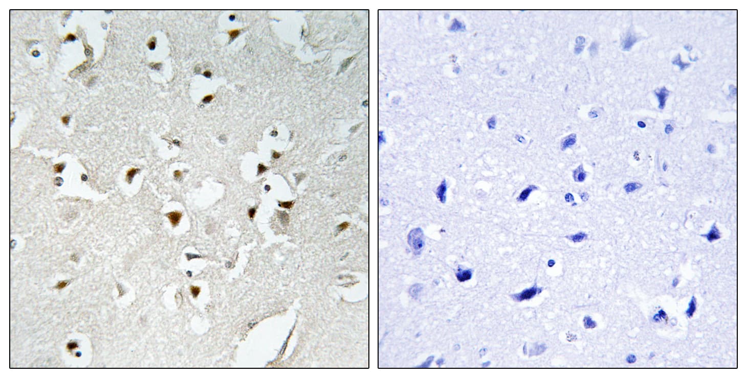 Polyclonal Rabbit anti-Human HPMS1 / PMS1 Antibody (aa441-490, IHC)
