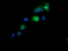 Monoclonal Mouse anti-Human KIF25 Antibody (clone OTI2B4, IF, WB)