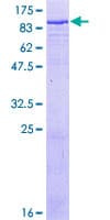 Human TF / Transferrin Protein (Recombinant GST)