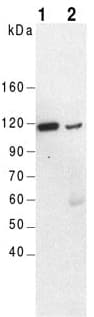 ACTN4 Antibody (aa27-38)