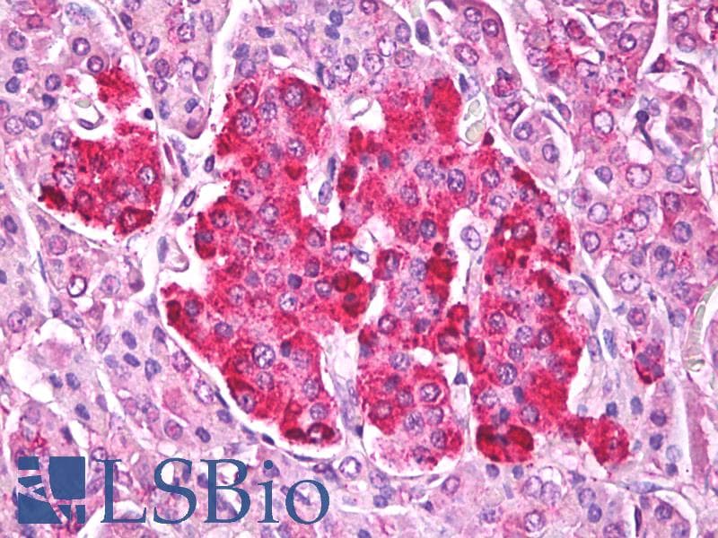 IHC-plus™ TTR / Transthyretin Antibody