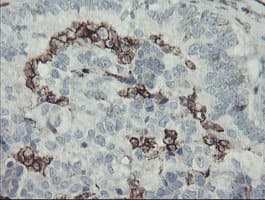PECAM-1 / CD31 Antibody (clone OTI3G4)