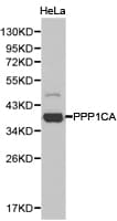 PPP1CA / PP1-Alpha Antibody