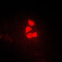 YAP / YAP1 Antibody (Internal)