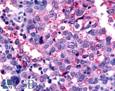 PathPlus™ Polyclonal Rabbit anti-Human GPR45 Antibody (C-Terminus, IHC)