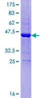 Human DESI1 / PPPDE2 Protein (Recombinant GST)
