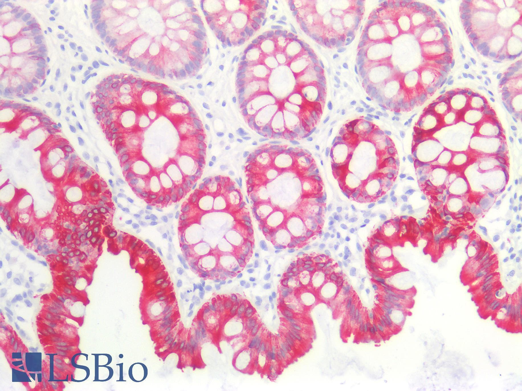 PathPlus™ KRT8 / CK8 / Cytokeratin 8 Antibody (C-Terminus)