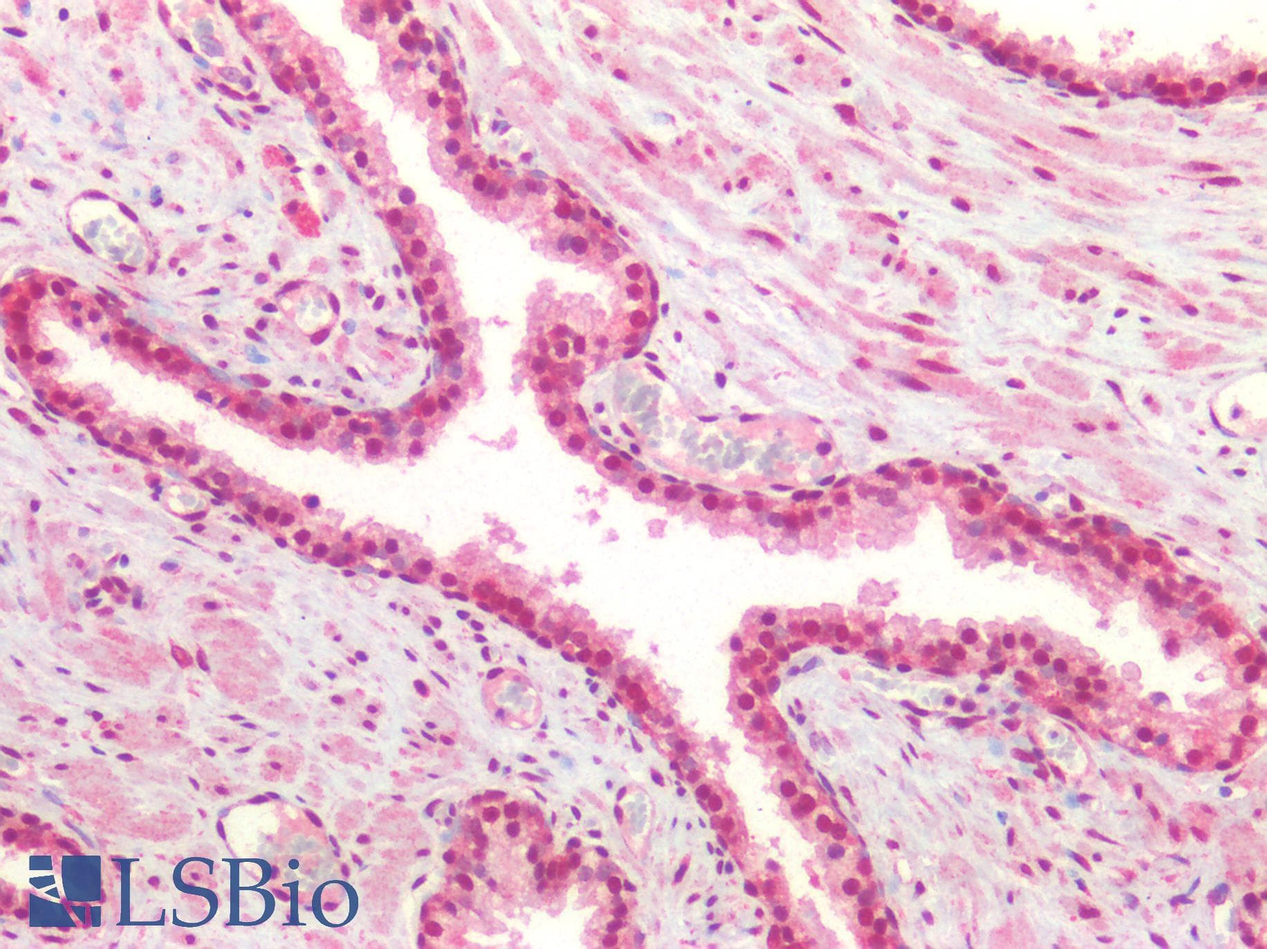 PathPlus™ Monoclonal Mouse anti-Human FOXP1 Antibody (clone JC12, IHC, WB)