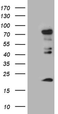 ELL / MEN Antibody (aa302-621, clone OTI4C4)