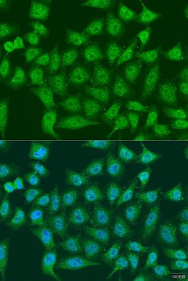 EGLN3 / PHD3 Antibody