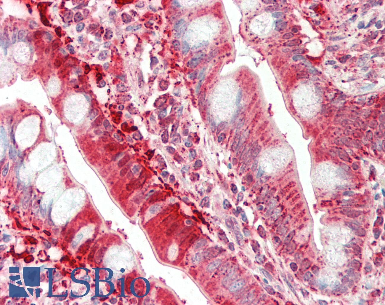 IHC-plus™ CHEK1 / CHK1 Antibody