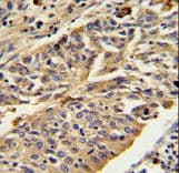 CTSE / Cathepsin E Antibody (aa157-187)