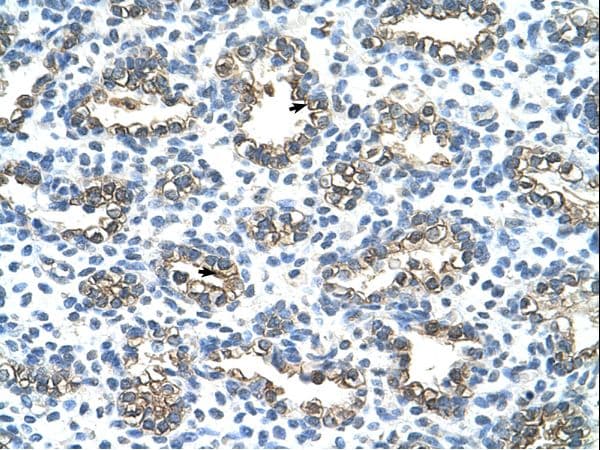 Polyclonal Rabbit anti-Human KRT13 / CK13 / Cytokeratin 13 Antibody (C-Terminus, IHC, WB)