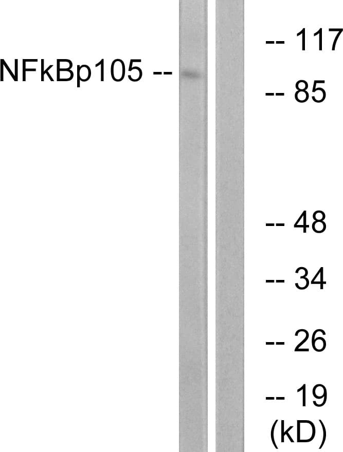 Polyclonal Rabbit anti-Human NFKB1 / NF-Kappa-B Antibody (aa899-948, IHC, WB)
