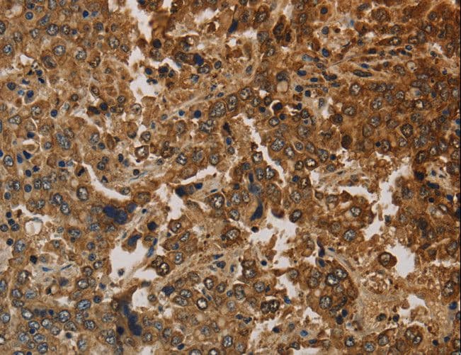 KRT16 / CK16 / Cytokeratin 16 Antibody