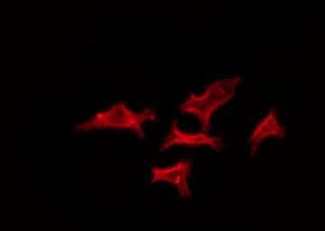 OR52K1 Antibody