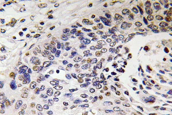 Polyclonal Rabbit anti-Human NEFH / NF-H Antibody (aa923-972, IHC)