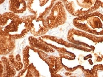 ACPP / PAP Antibody (clone SPM312, Azide-free, BSA-free)