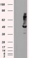 IFT57 / HIPPI Antibody (clone OTI4F6)