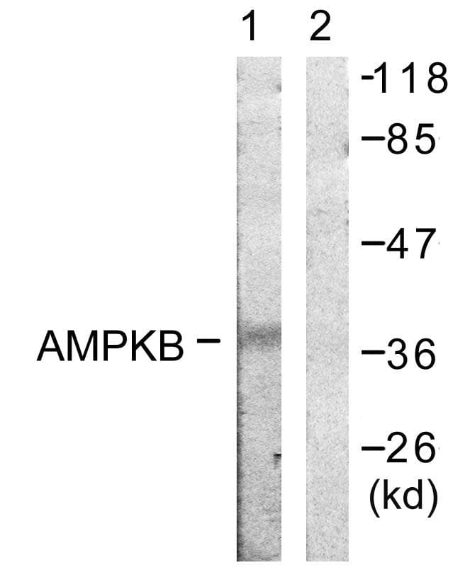 Polyclonal Rabbit anti-Human PRKAB1 / AMPK Beta 1 Antibody (p181, IHC, WB)