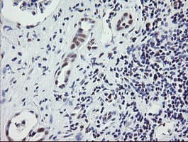 ZBED1 / TRAMP Antibody (clone OTI2A7)