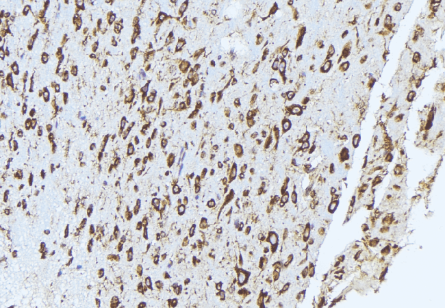 QSOX1 / QSCN6 Antibody
