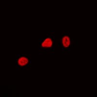 CDCA4 Antibody (Internal)