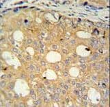 CMPK2 Antibody (aa142-170)