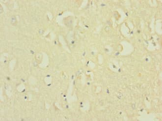 NRXN1 / Neurexin 1 Antibody