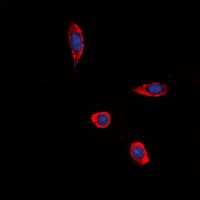 Polyclonal Rabbit anti-Human P2Y13 / P2RY13 Antibody (Internal, IF, WB)