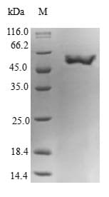 Human GNA15 Protein (Recombinant TRX-6His, N-terminus)