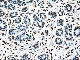 Monoclonal Mouse anti-Human TYRO3 Antibody (clone OTI2G2, IHC, WB)