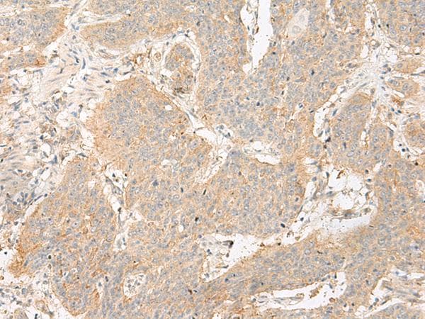 Polyclonal Rabbit anti-Human GP6 / GPVI Antibody (IHC)