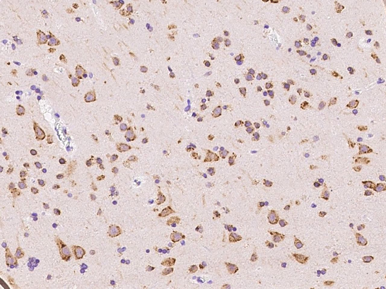 SSR3 / TRAP-Gamma Antibody