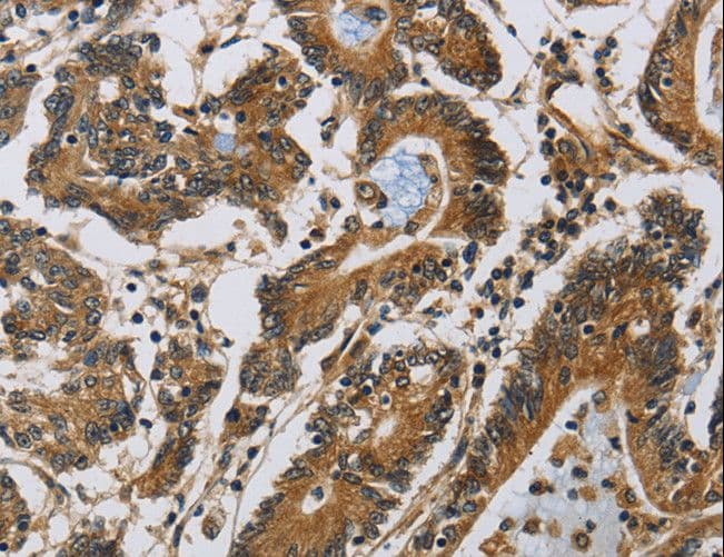Polyclonal Rabbit anti-Human CLDN2 / Claudin 2 Antibody (IHC)