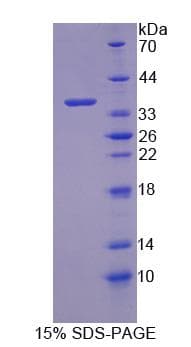 Mouse PCTK3 / CDK18 Protein (Recombinant)
