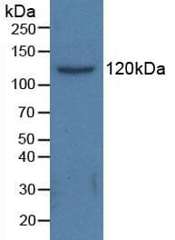 HDAC6 Antibody (aa166-348)