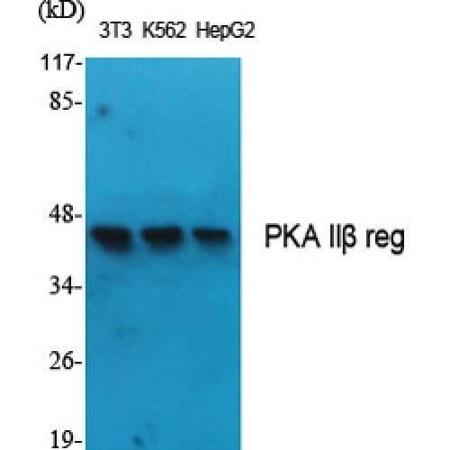 PRKAR2B Antibody (50-130 aa)
