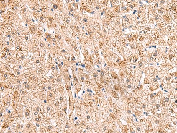 Polyclonal Rabbit anti-Human HCCS Antibody (IHC, WB)