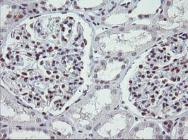 Monoclonal Mouse anti-Human KIF25 Antibody (clone OTI2D6, IHC, WB)
