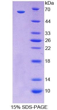 Human CDX2 Protein (Recombinant His-GST)