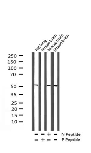 MAP2K1 / MKK1 / MEK1 Antibody (phospho-Ser217)
