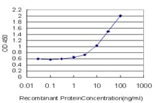 IHC-plus™ Monoclonal Mouse anti-Human GALT Antibody (clone 4C11, IHC, WB)