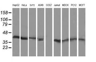 MAP2K3 / MEK3 / MKK3 Antibody (clone OTI3C8)